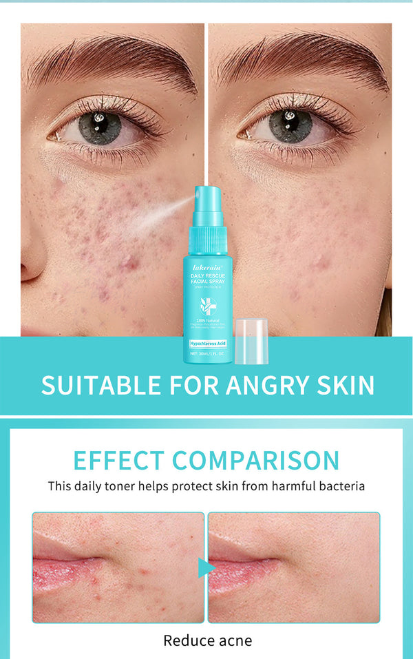 Lakerain Facial First Aid Spray Hypochlorous Skin