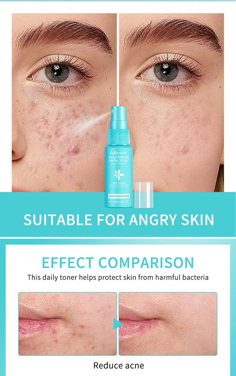 Lakerain Facial First Aid Spray Hypochlorous Skin